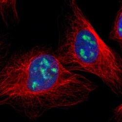 DDX47 Antibody, Novus Biologicals 0.1mL; Unlabeled:Antibodies, Polyclonal